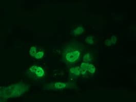 ARNT / HIF-1-Beta Antibody (clone OTI2C7)