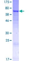 Human CST / GAL3ST1 Protein (Recombinant GST)