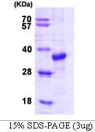 Human STUB1 / CHIP Protein (Recombinant)
