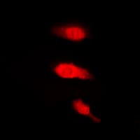 ELAVL2 / HUB Antibody (Internal)