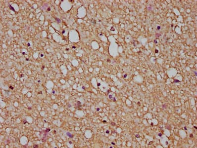 GFAP Antibody