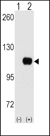 Polyclonal Rabbit anti-Human HK1 / Hexokinase 1 Antibody (aa705-734, IHC, WB)