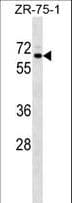 Polyclonal Rabbit anti-Human SRPR Antibody (aa453-480, WB)