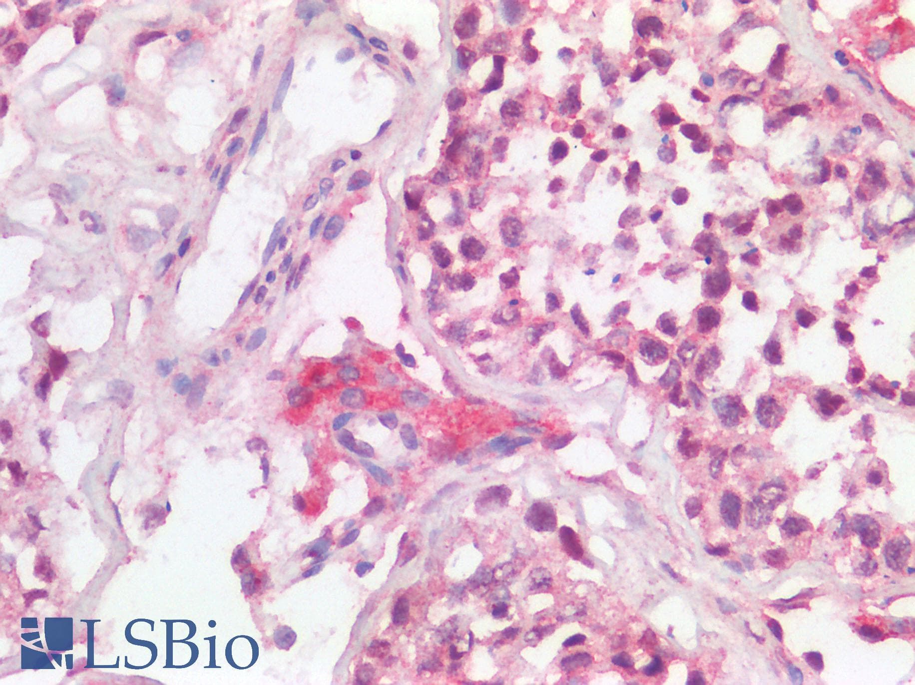 PathPlus™ ACE2 / ACE-2 Antibody