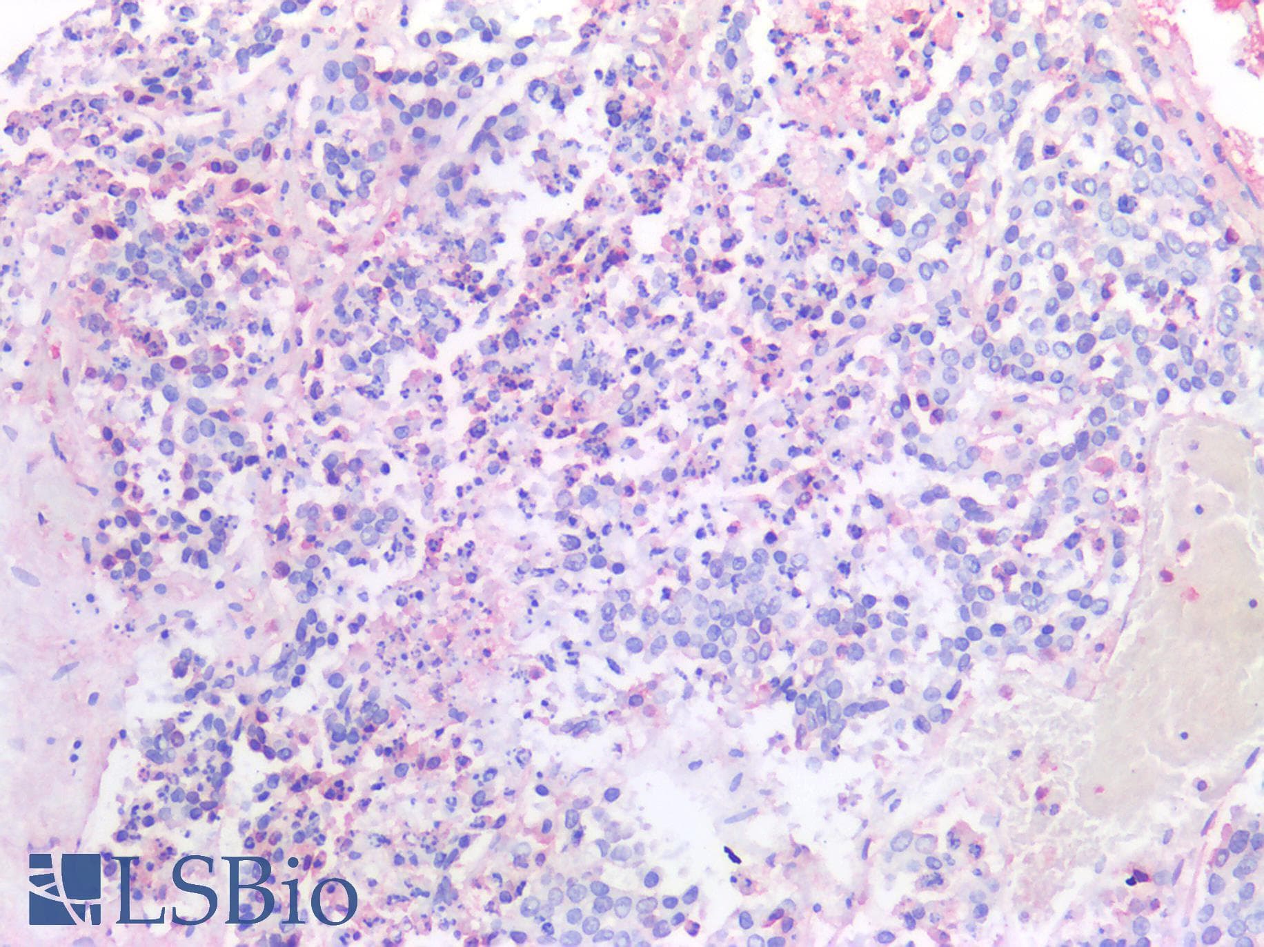 PathPlus™ Alpha-Fetoprotein Antibody (clone OTI2E2)