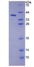 Human TPBG / 5T4 Protein (Recombinant His,N-terminus)