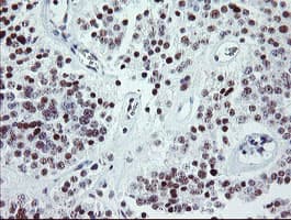 ZBED1 / TRAMP Antibody (clone OTI2A7)