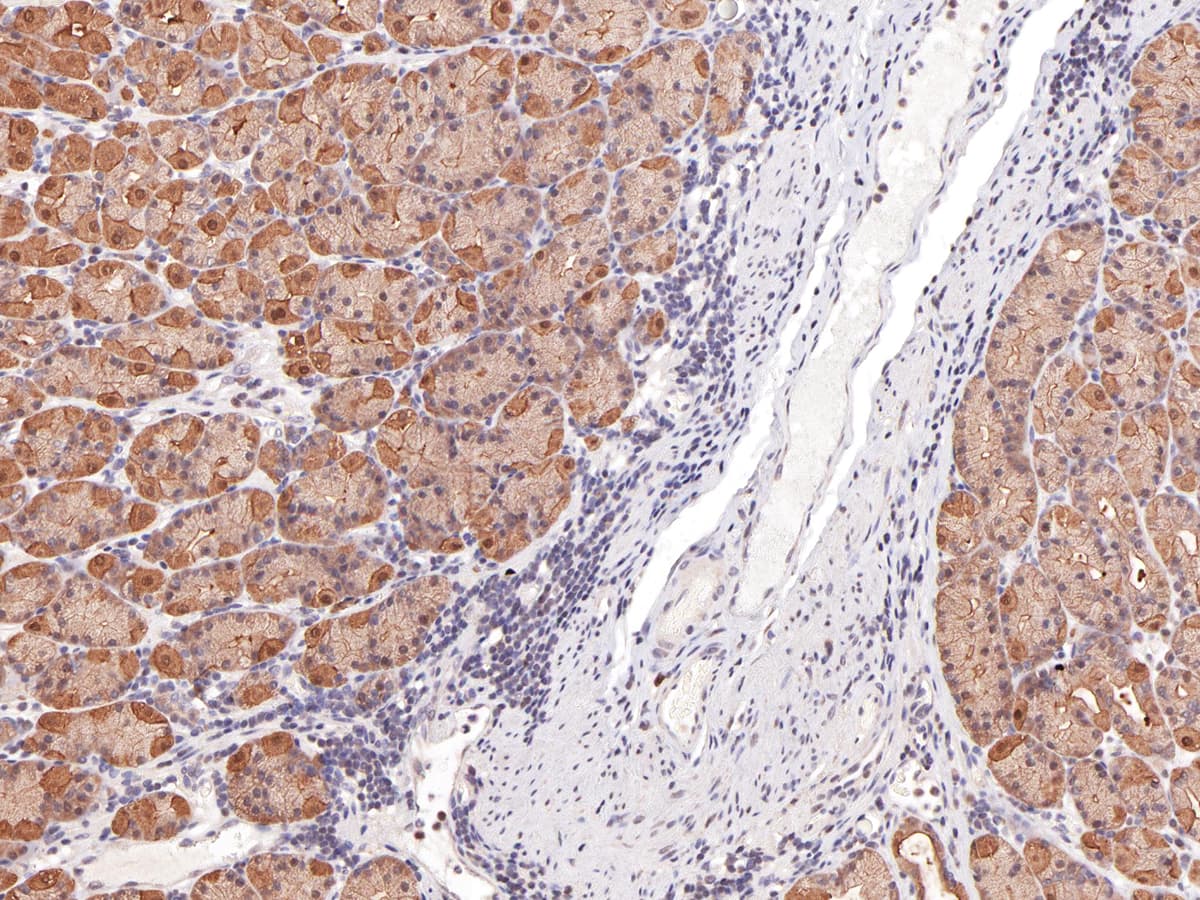 Monoclonal Mouse anti-Human BIRC5 / Survivin Antibody (Concentrated, IHC)