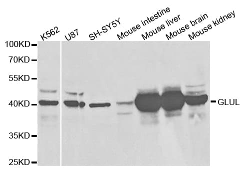 GLUL / Glutamine Synthetase Antibody