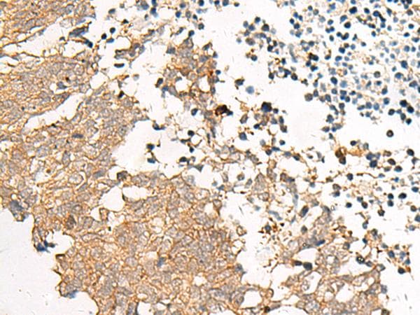 Polyclonal Rabbit anti-Human GPR22 Antibody (IHC, WB)