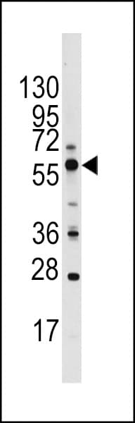 GOPC / PIST Antibody (aa361-390)