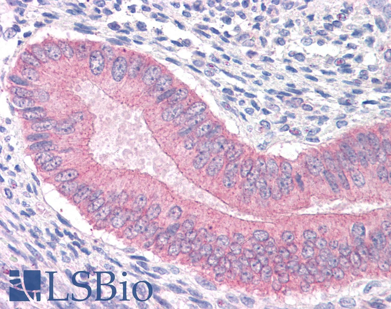 IHC-plus™ Polyclonal Goat anti-Human CTNNA1 / Catenin Alpha-1 Antibody (aa871-883, IHC, WB)