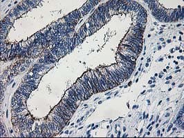 LIMK1 / LIMK Antibody (clone OTI3G3)