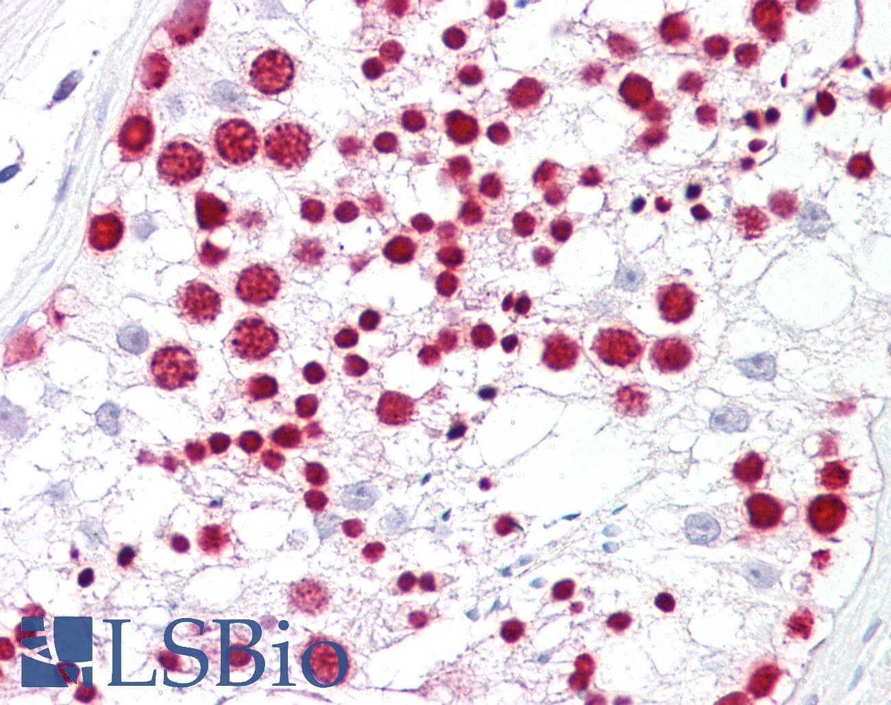 IHC-plus™ Polyclonal Rabbit anti-Human NPM1 / NPM / Nucleophosmin Antibody (aa201-250, IHC, IF, WB)