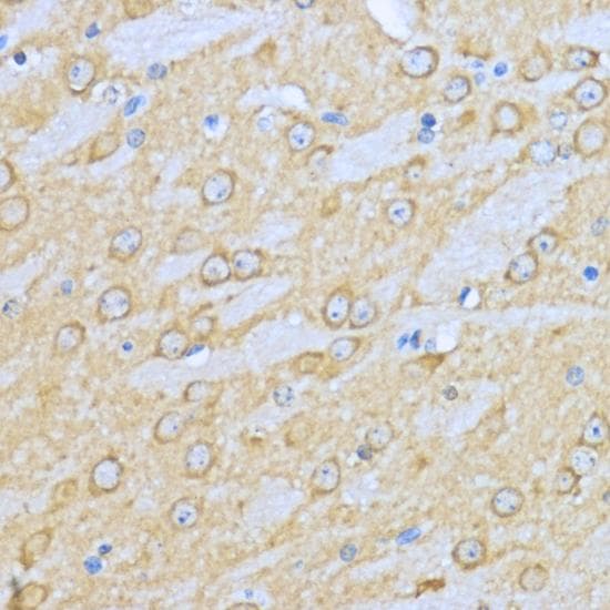 HSP90AA1 / Hsp90 Alpha A1 Antibody
