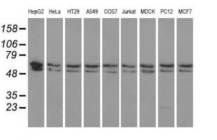 Monoclonal Mouse anti-Human PANK2 Antibody (clone OTI3H9, IHC, IF, WB)