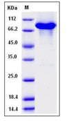 Human KEAP1 Protein (Recombinant His-GST-AVI, N-terminus)