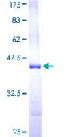 Human TRIM5 Protein (Recombinant GST, N-terminus)