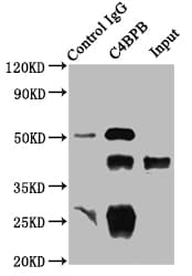 C4BPB / C4BP Beta Antibody (aa18-252)