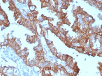 CD74 / CLIP Antibody (clone SPM523, Azide-free, BSA-free)