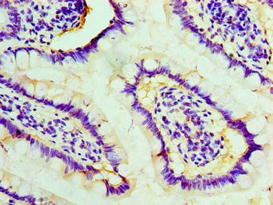 STI1 / STIP1 Antibody