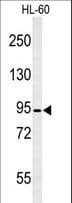 CAPN3 / Calpain 3 Antibody (aa603-632)