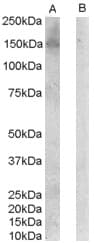PathPlus™ Polyclonal Goat anti-Human ERBB3 / HER3 Antibody (aa1300-C-term, IHC, IF)