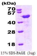 Human HOMER1 / Homer 1 Protein (Recombinant His)