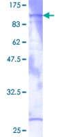 Human PKG / PRKG1 Protein (Recombinant GST)