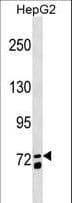 Polyclonal Rabbit anti-Human MS4A14 / MS4A13 Antibody (aa556-585, WB)