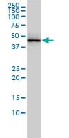 IHC-plus™ TDP-43 / TARDBP Antibody (clone 2E2-D3)