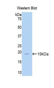 TNC / Tenascin C Antibody (aa356-495)