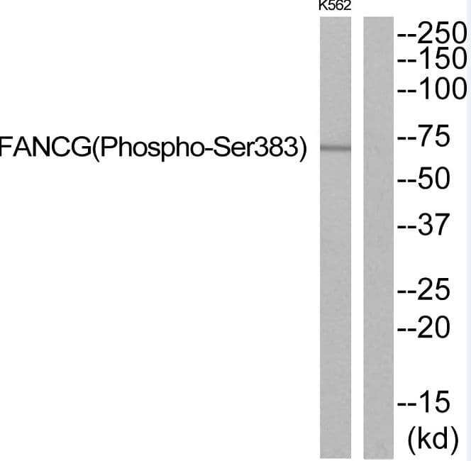 FANCG Antibody (phospho-Ser383)
