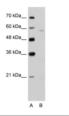 SLC22A7 / OAT2 Antibody (aa51-100)