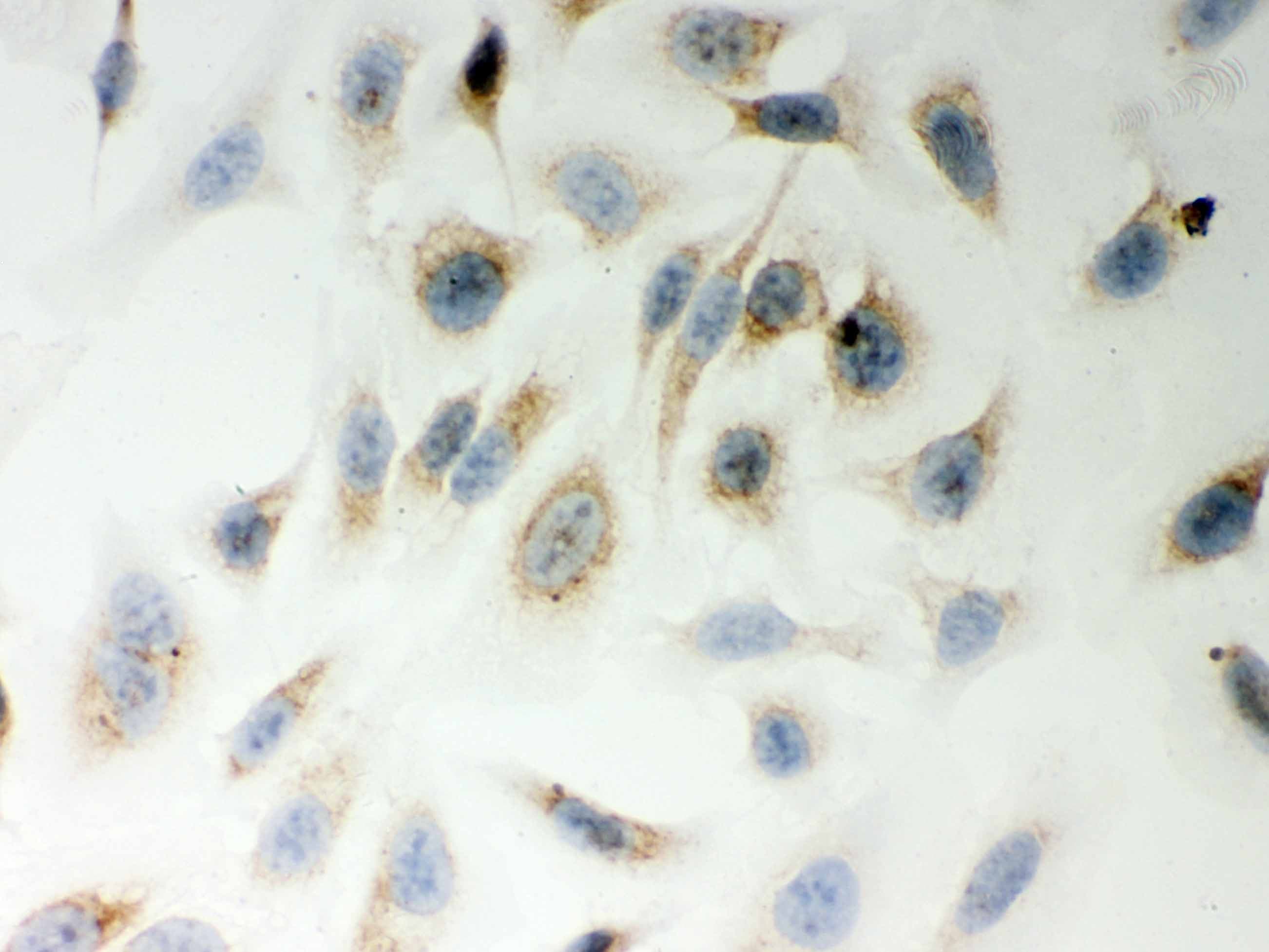 Polyclonal Rabbit anti-Human MTDH / Metadherin Antibody (aa101-270, IHC, WB)