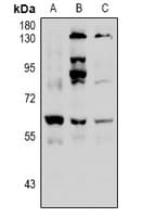 Polyclonal Rabbit anti-Human HDAC2 Antibody (WB)