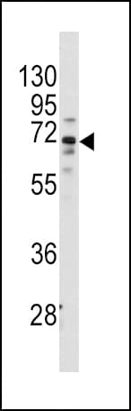 Polyclonal Rabbit anti-Human FZD1 / Frizzled 1 Antibody (aa367-396, IHC, WB)