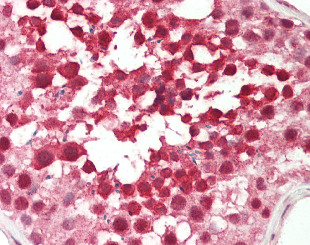 RBBP4 / RBAP48 Antibody (aa71-120)