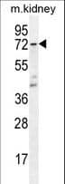 Polyclonal Rabbit anti-Human TS / Thromboxane Synthase Antibody (aa226-257, IHC, WB)