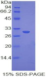 Mouse MYO1E / Myosin IE Protein (Recombinant His)