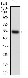 Monoclonal Mouse anti-Human CSF1R / CD115 / FMS Antibody (clone 6B9B9, aa344-497, IHC, IF, WB)