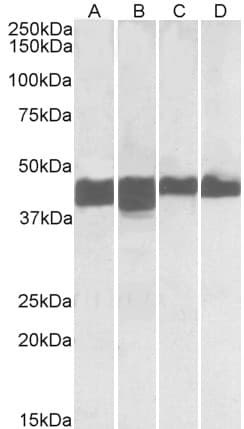 IHC-plus™ CKM / Creatine Kinase MM Antibody (aa5-18)