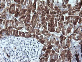 Monoclonal Mouse anti-Human LGALS3 / Galectin 3 Antibody (clone 1G8, Carrier-free, IHC, IF, WB)