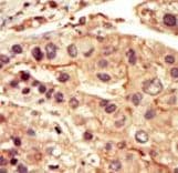 Polyclonal Rabbit anti-Human SRMS Antibody (aa456-485, IHC, WB)