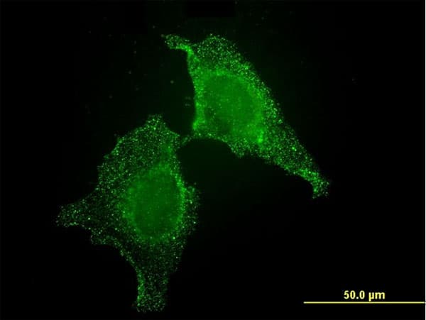CIB1 / KIP Antibody (clone 4D2-3A8)
