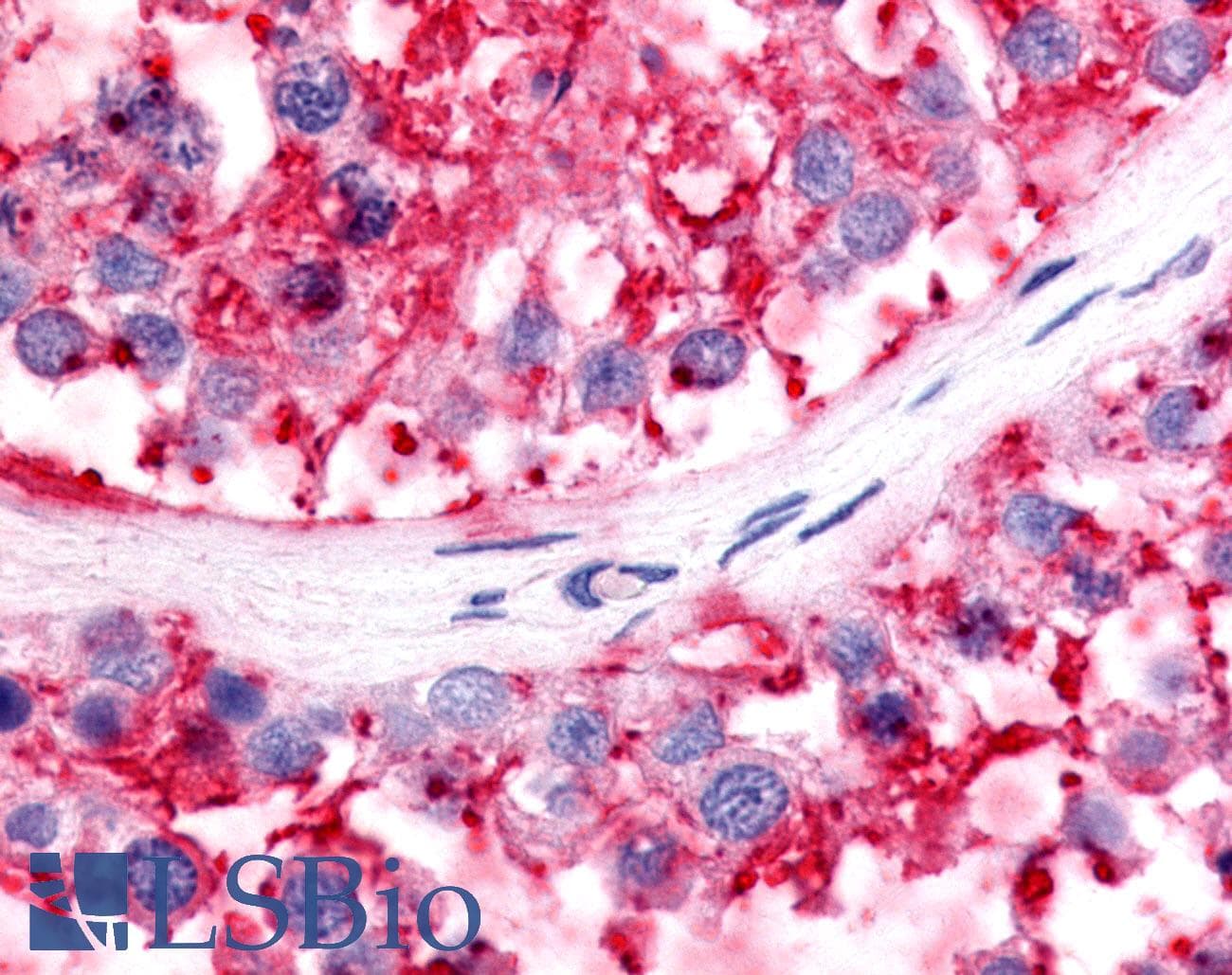 PathPlus™ NR5A2 / LRH-1 Antibody (C-Terminus)