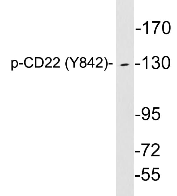 Polyclonal Rabbit anti-Human CD22 Antibody (phospho-Tyr842, WB)