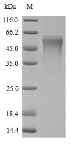 Rat Trypsin-4 Protein (Recombinant 6His-SUMOstar, N-terminus)