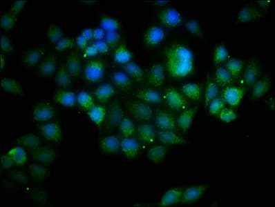 BCL10 / BCL-10 Antibody