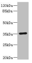 Polyclonal Rabbit anti-Human CD32C Antibody (IHC, WB)